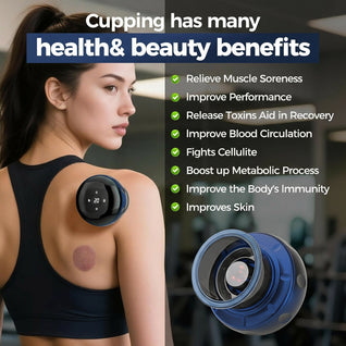 Smart Electric Cupping Massager